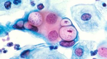 Sex Question Friday: Do STDs Affect Women’s Ability To Reach Orgasm?