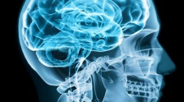 Sex Question Friday: What Does a Gay Brain Look Like?
